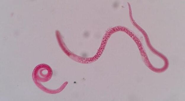 Wie sehen Trichinellen aus