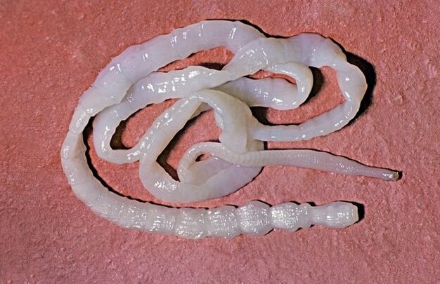 Wie sieht ein Bullenbandwurm aus