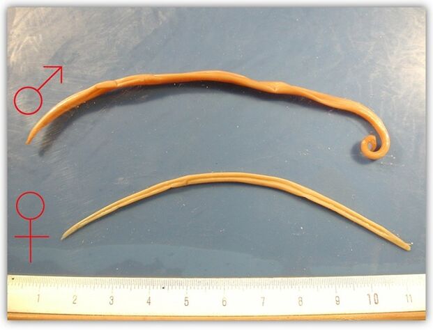 wie Spulwürmer aussehen