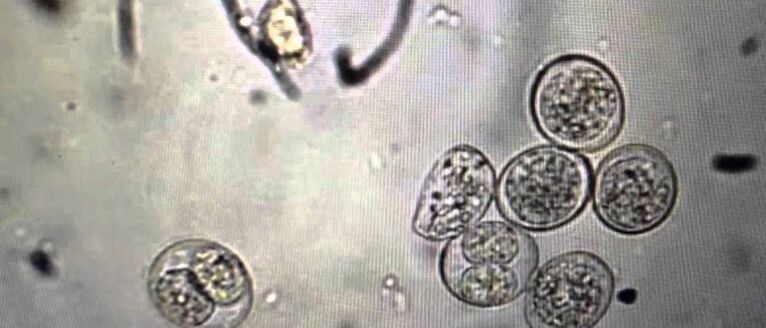 parasitäre Protozoenzellen